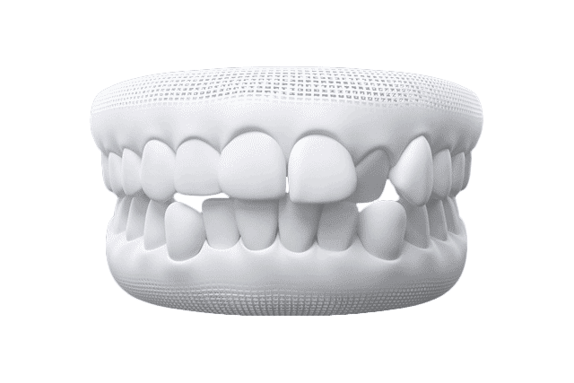 Invisalign in Albania