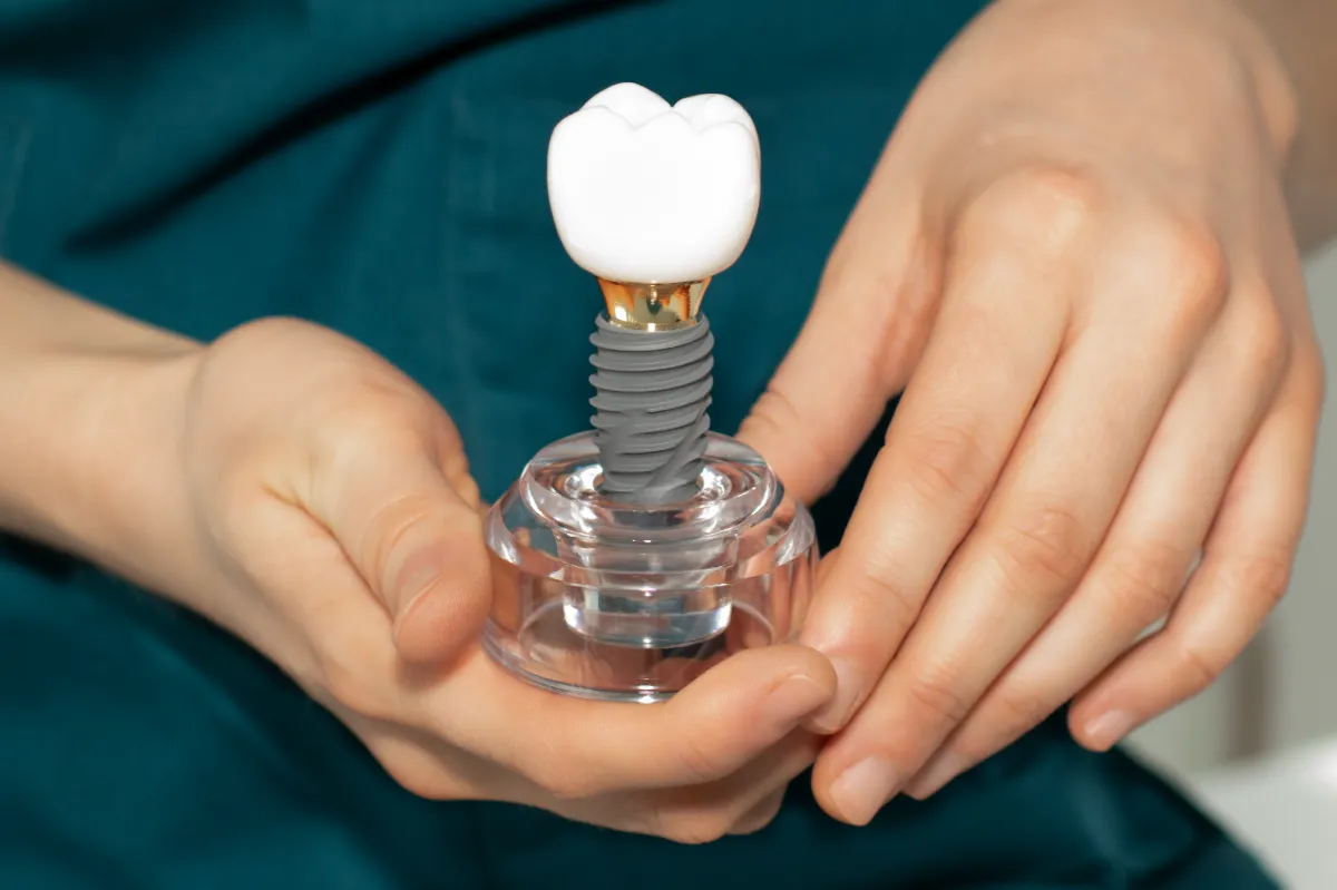Cost of Dental Implants in Albania