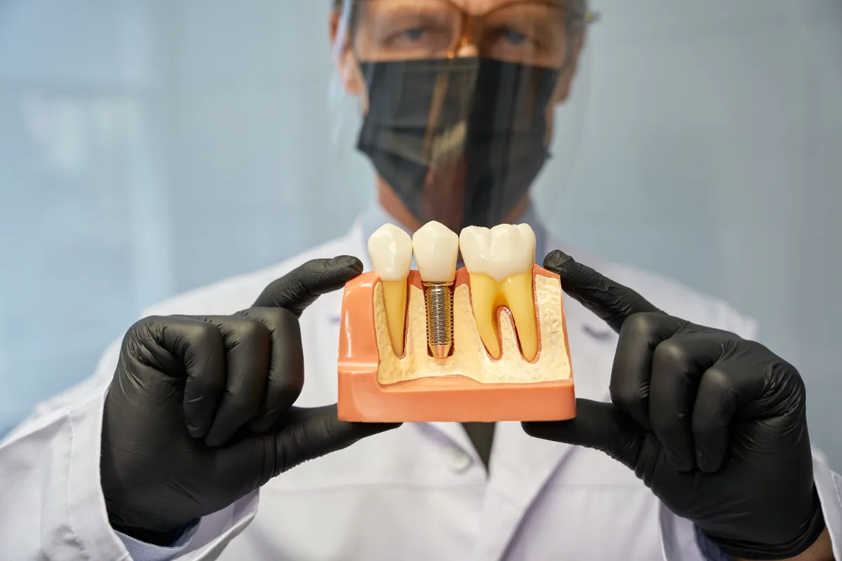 Dental Implants in Albania