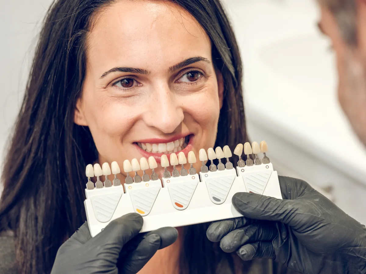 Emax Veneers in Albania