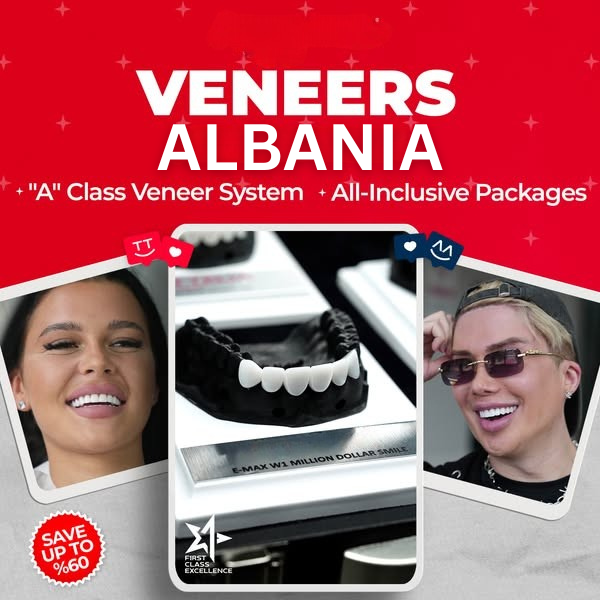 Veneers Albania