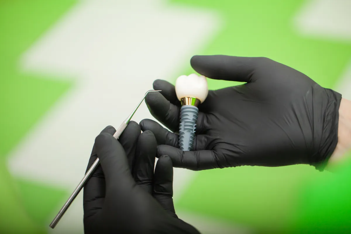 Zirconia Implants in Albania