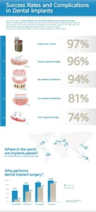 What percentage of people reject dental implants?