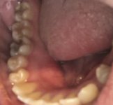 What to do if you haven't gone to the dentist in 10 years?