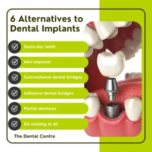 Is there a cheaper alternative to dental implants in the UK?