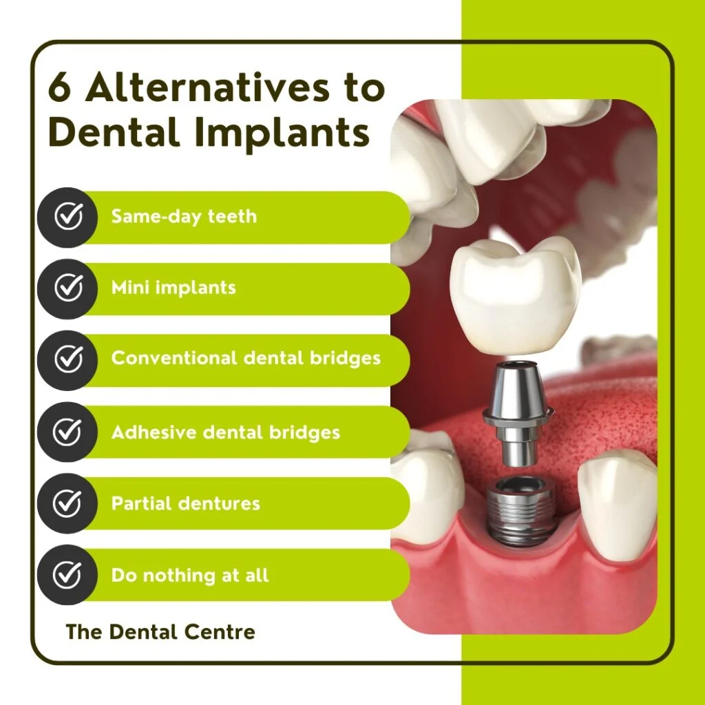 Is there a cheaper alternative to dental implants in the UK?