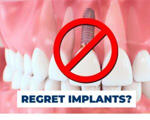 When not to get dental implants?