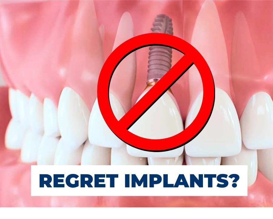 When not to get dental implants?