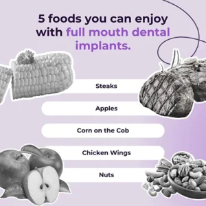 Can you eat with full mouth dental implants?
