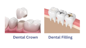 Why do dentists push crowns?