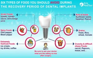 Is it hard to eat with dental implants?