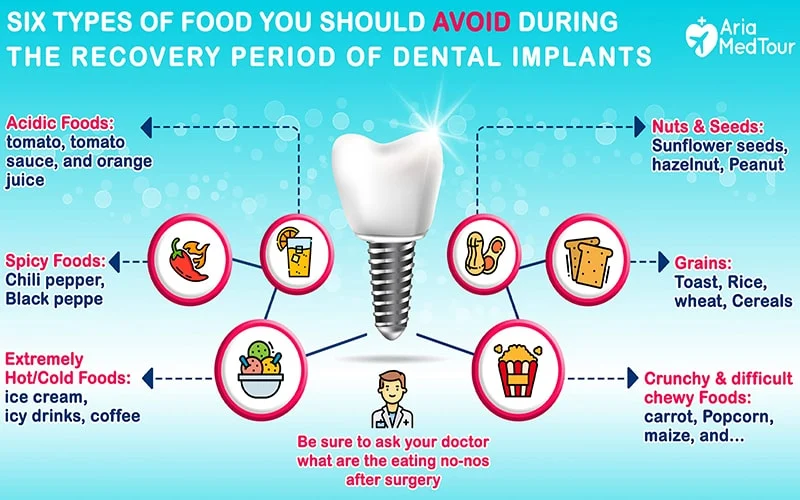 What foods can you not eat with dental implants?