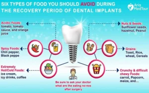 Do you lose weight after dental implant surgery?