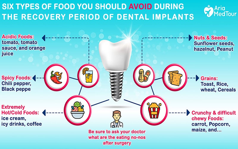 How soon can I eat after a dental implant?