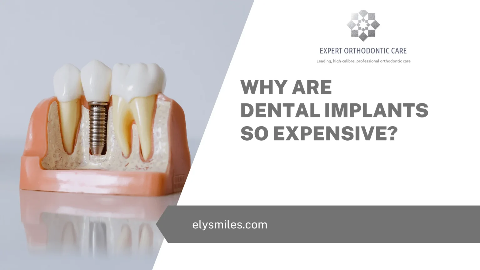 Why are dental implants so expensive in UK?