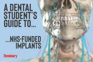 Does the NHS fund dental implants?