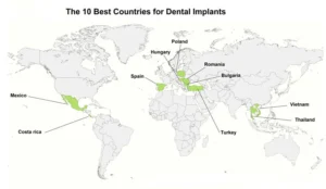 What country is best for dental implants?