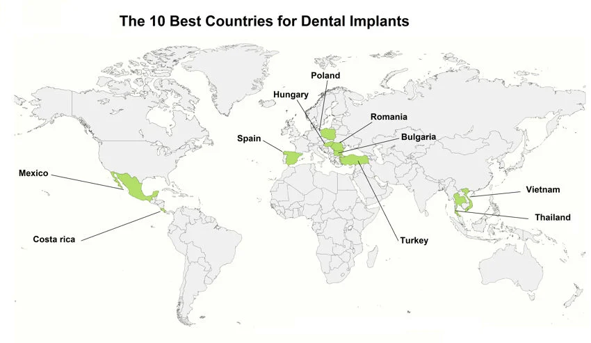 What country is best for dental implants?