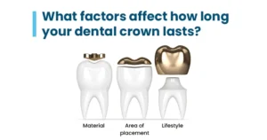 How long does a dental crown last?