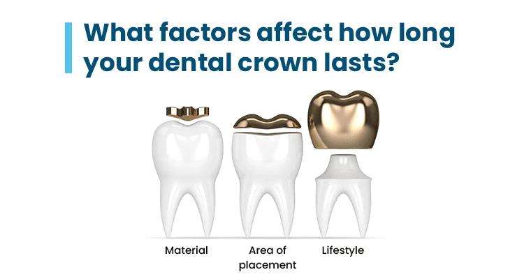 How long does a dental crown last?