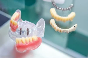 Who is a good candidate for mini dental implants