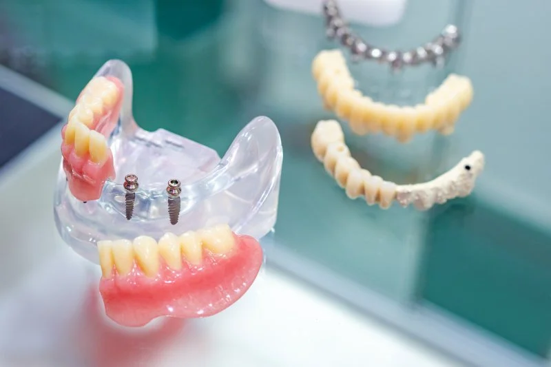 Who is a good candidate for mini dental implants