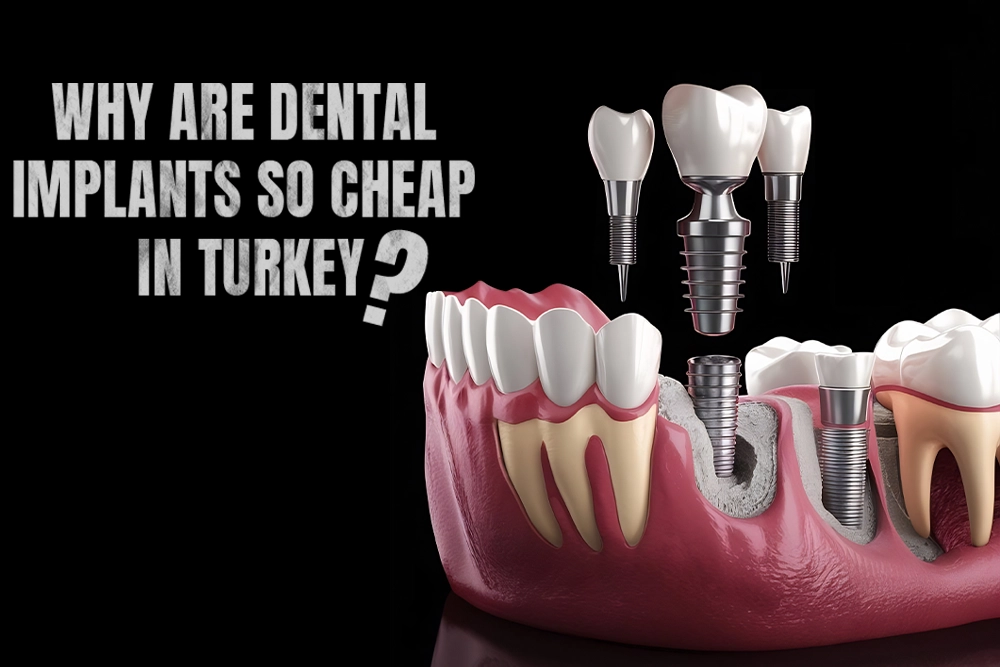 Why are dental implants so cheap in Turkey?