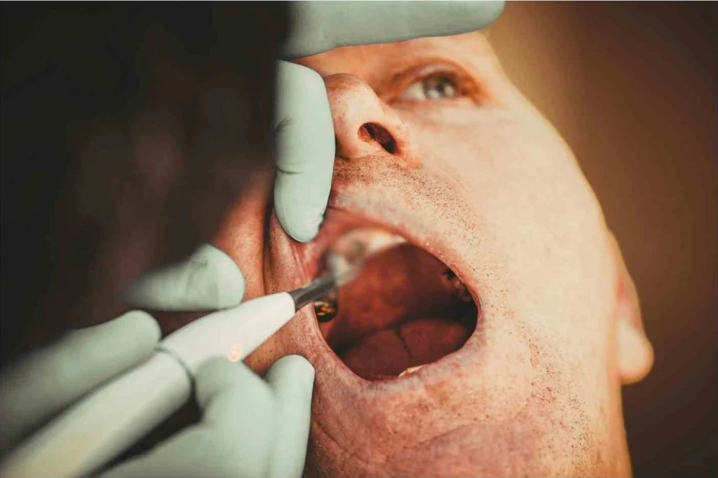 Will my body reject dental implants?
