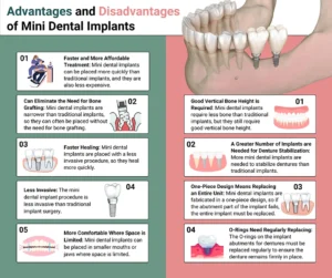 What is the downside of mini implants?