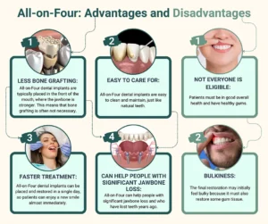 What are the cons of All-on-4 implants?