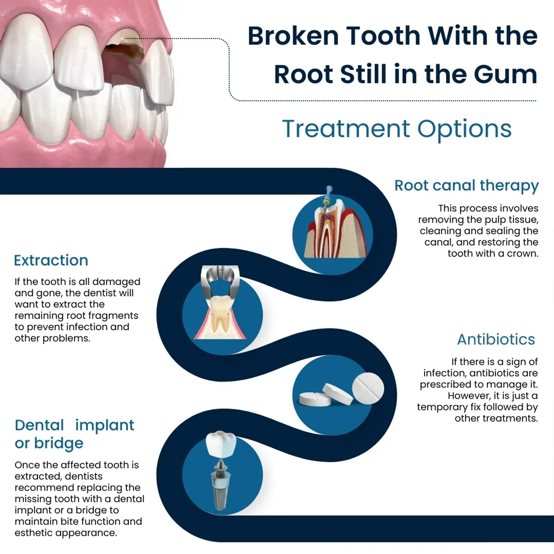 What happens if a tooth root is left in the gum NHS?