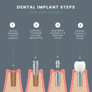 When is it too late to get an implant after tooth extraction?