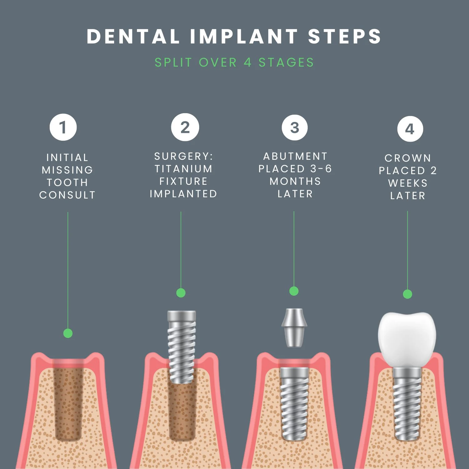 When is it too late to get an implant after tooth extraction?