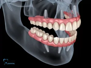 Do you get temporary teeth while waiting for implants?