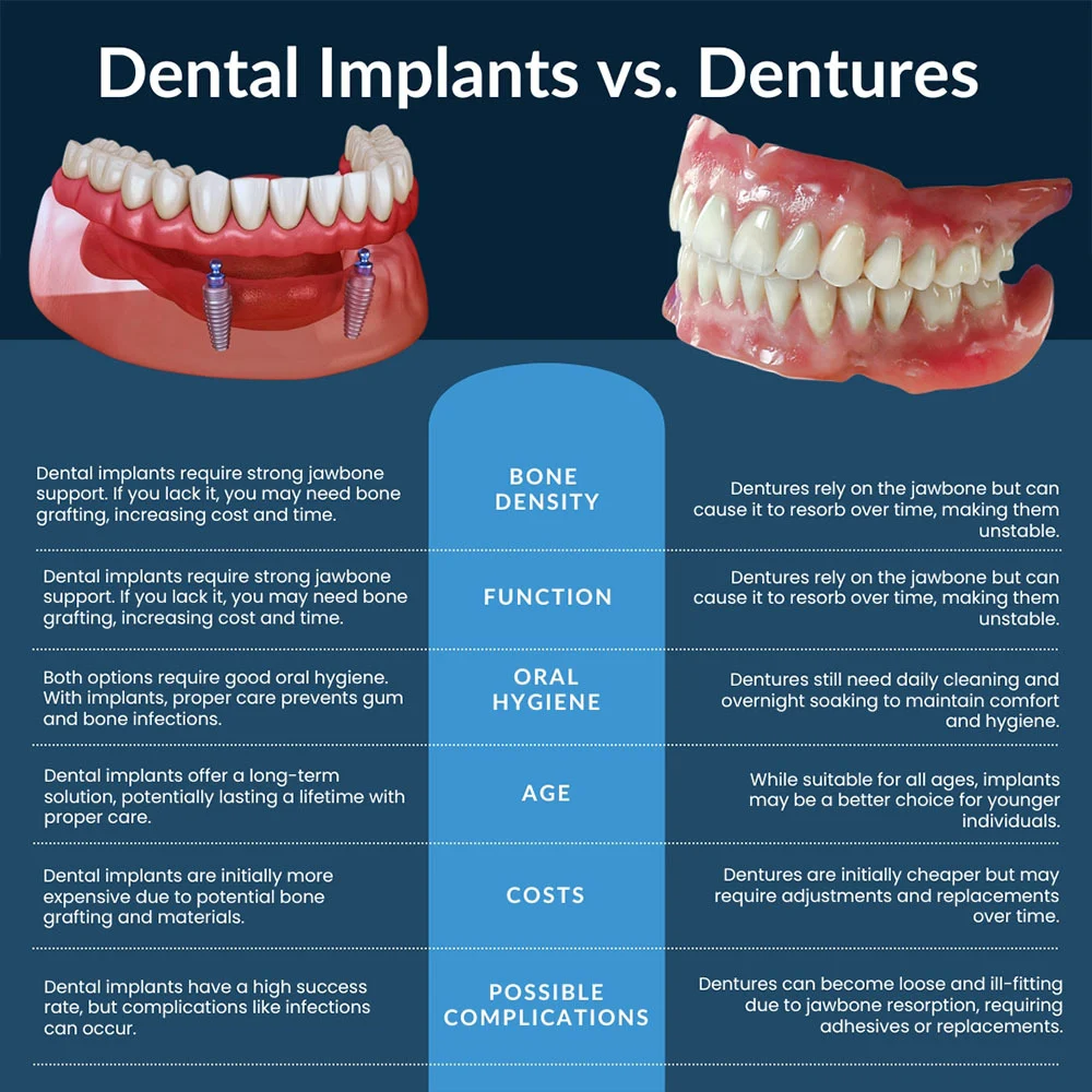 Which is cheaper implants or dentures?