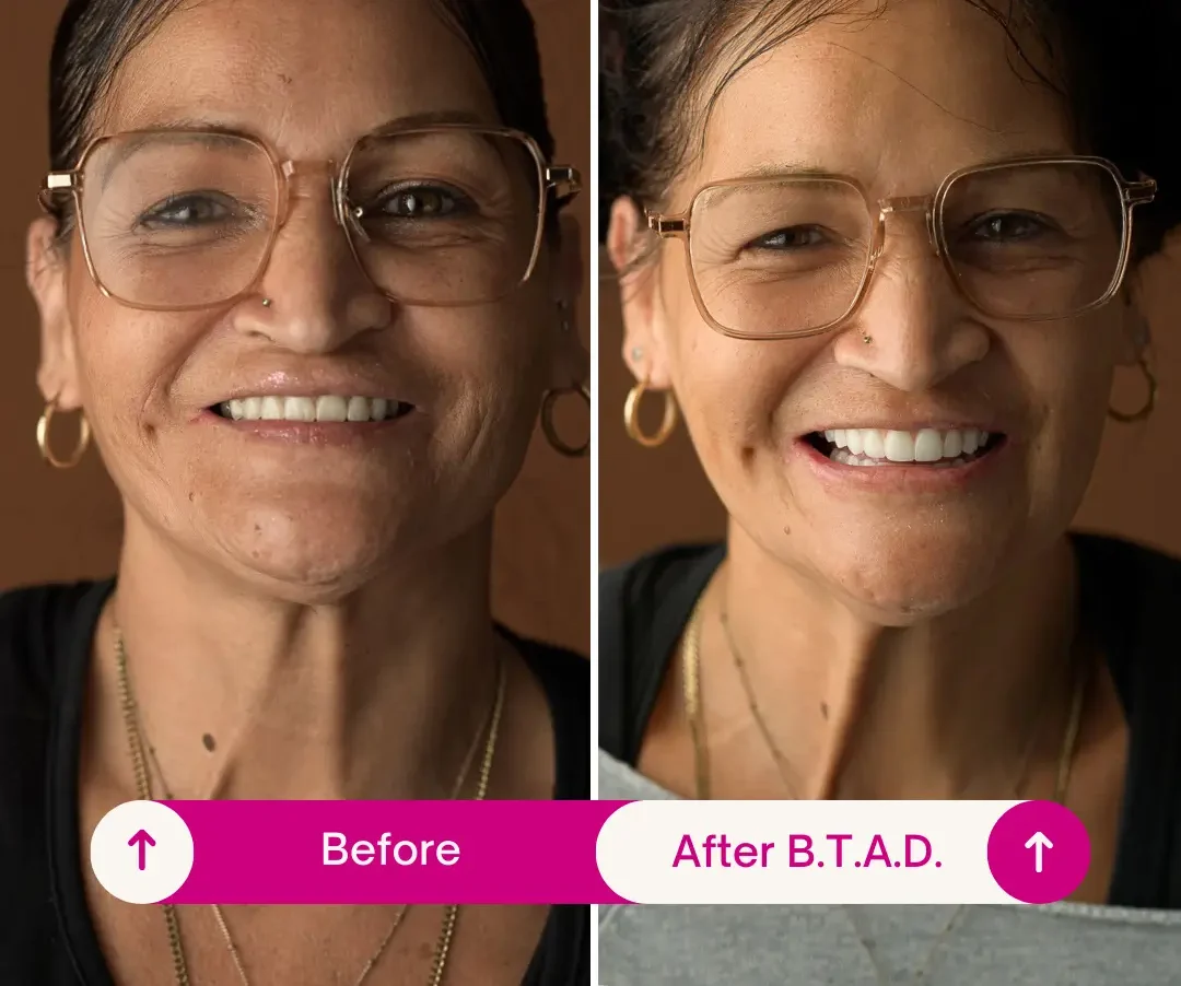 Can your body reject dental implants years later?