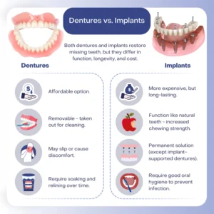 Should I get dentures or implants?