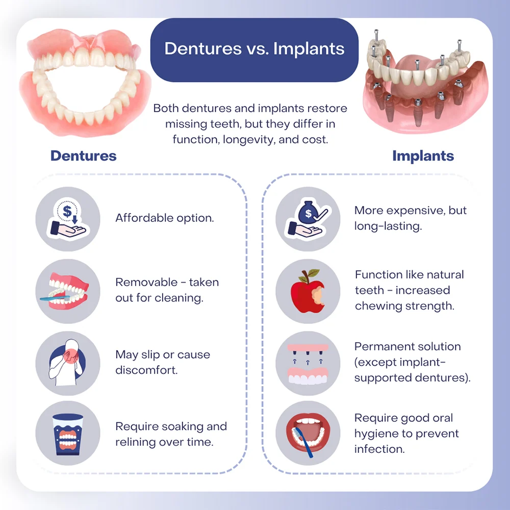 Should I get dentures or implants?