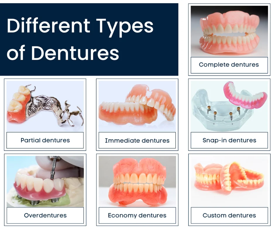 What are the three types of dentures?
