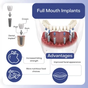 How painful are full mouth dental implants?