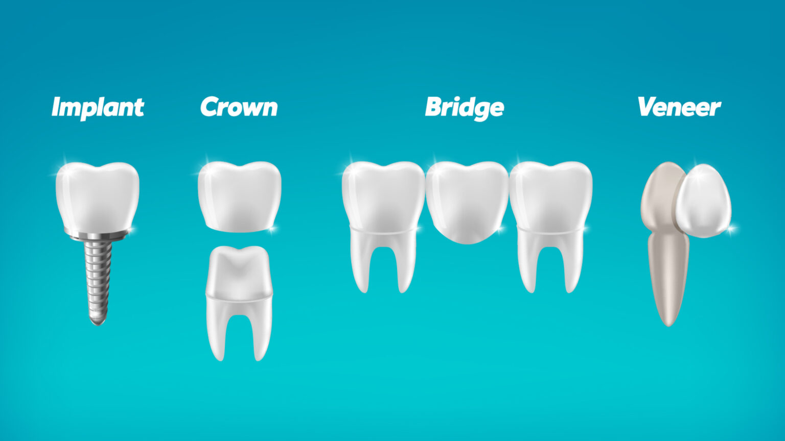 Do I qualify for dental implants on the NHS?