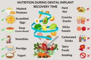 Can you eat chips with implants?