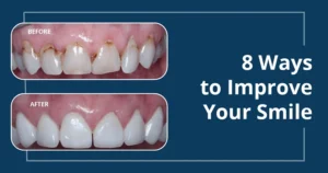 How can I fix my teeth if I don't have money?