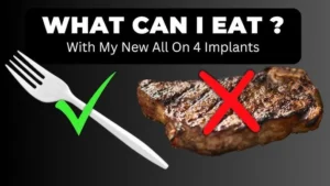 Can you eat steak with all on four implants?