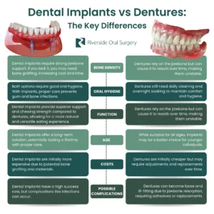 Are implants better than dentures?