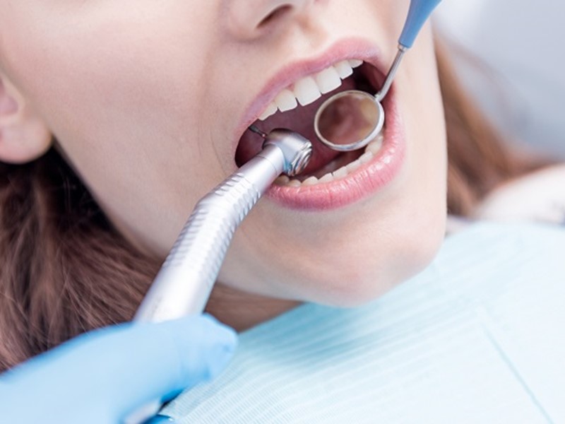 What happens if you don't go to the dentist for 7 years?