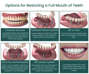 How many dental implants do you need for whole mouth?