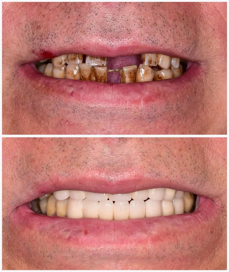 What can you do if you have bad teeth and no money in the UK?
