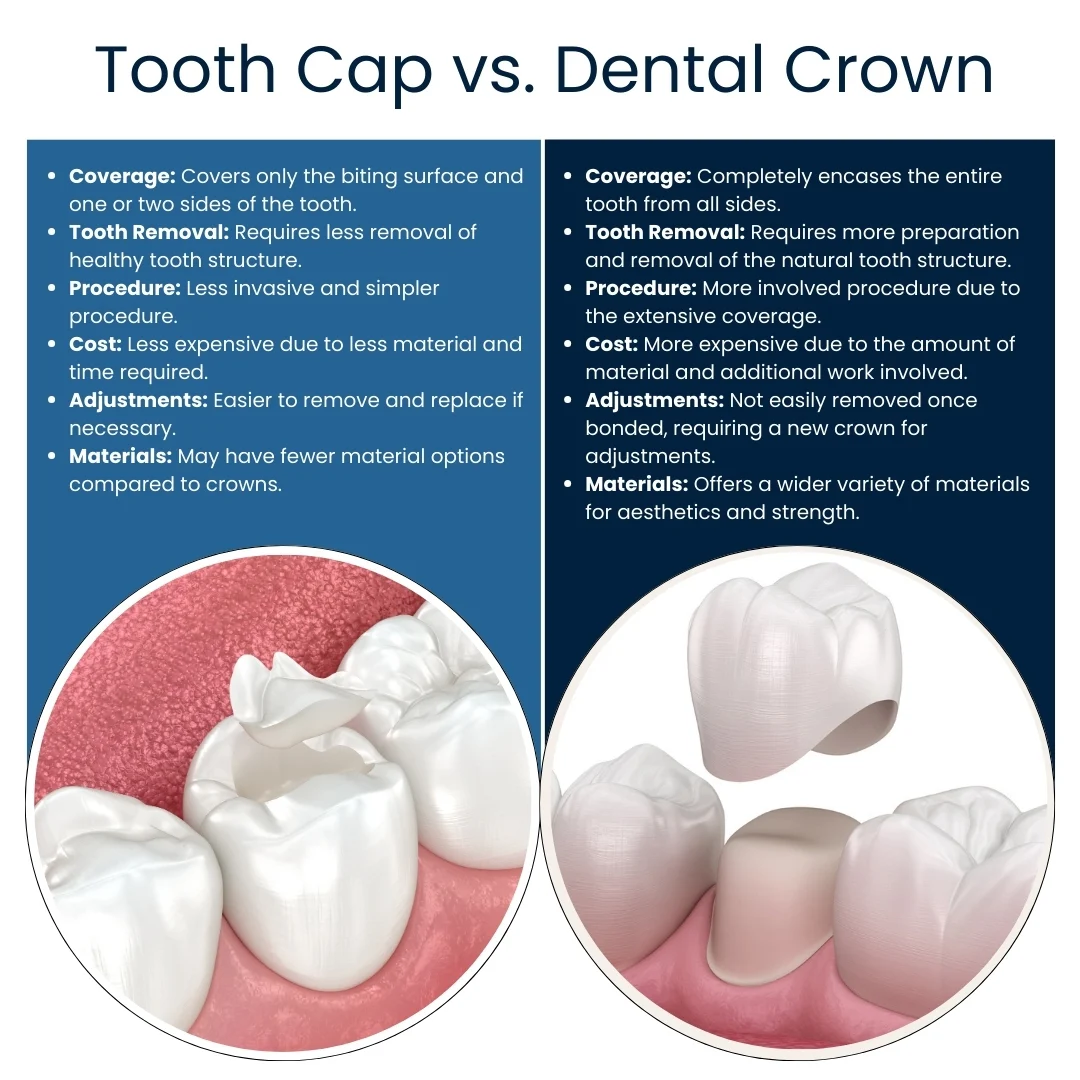 What is the difference between a cap and a crown?