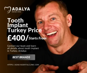How much is a tooth implant in Turkey?